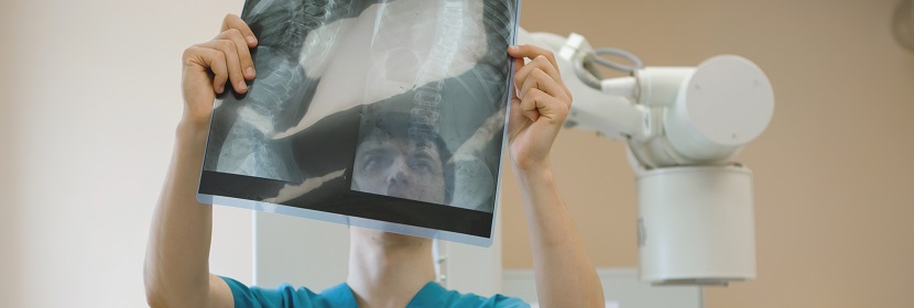 移動CR放射衛生檢測評價