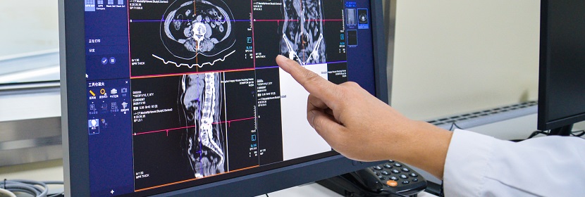X射線計(jì)算機(jī)體層攝影(CT)裝置放射衛(wèi)生檢測評價(jià)